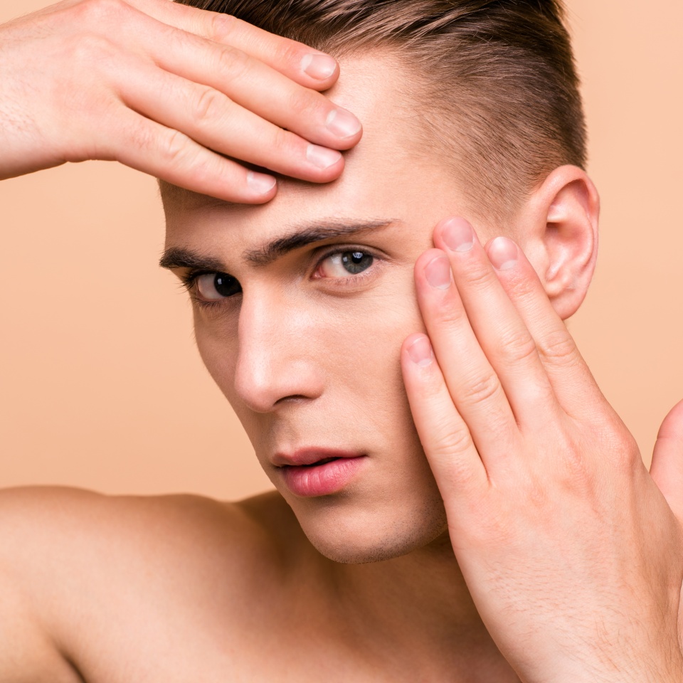 Close up portrait of sad, upset, frustrated, disappointed, naked brown haired man isolated on pastel beige background touching brow with fingers looking for acne on his face