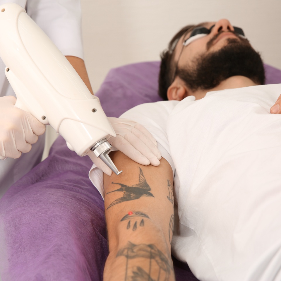Young man undergoing laser tattoo removal procedure in salon