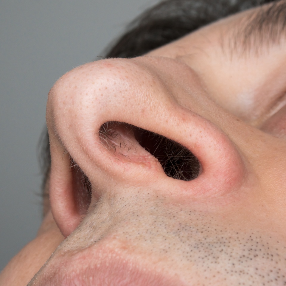 Up the nose, low angle shot of male nostril holes and nose hairs.
