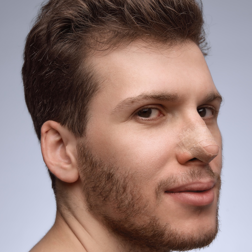 Man smiling slightly with nose bandage during early recovery. Concept of postoperative communication, clinic marketing, healing-stage documentation, and patient care visuals.